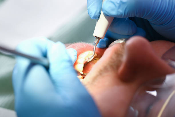 Best Urgent Tooth Repair  in Adamsville, TN