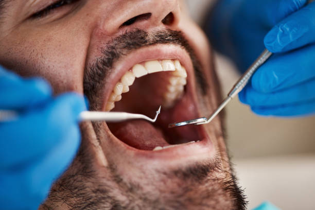 Best Chipped Tooth Repair Near Me  in Adamsville, TN